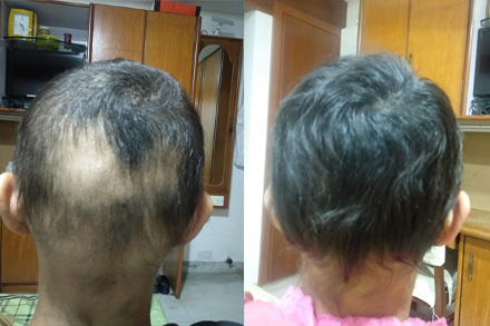 Hair Treatment Result